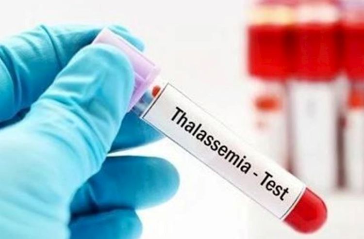 Azərbaycanda talassemiya xəstələrinin sayı açıqlanıb