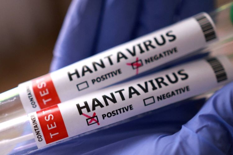 Azərbaycanda hantavirus təhlükəsi varmı? - ÜST-dən açıqlama