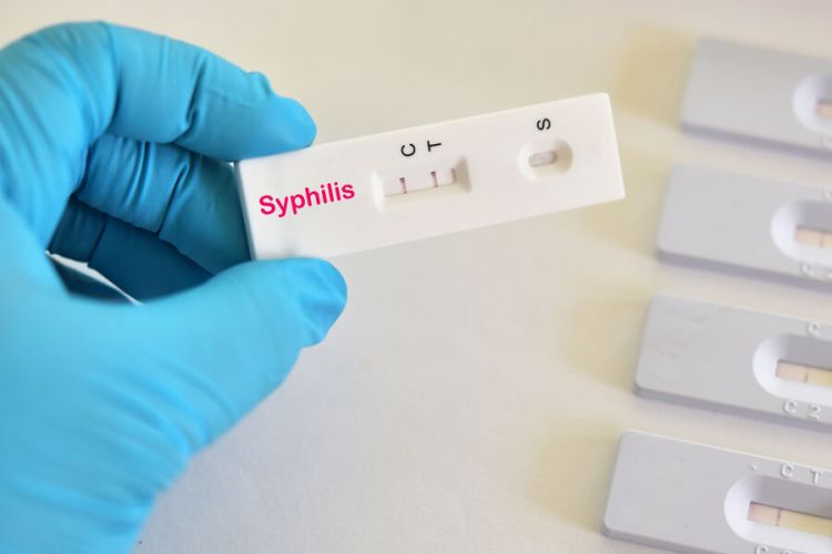 Avropada sifilisə yoluxma rekord səviyyəyə çatıb