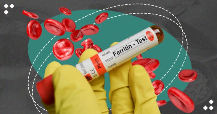 Ferritinin miqdarı insanın çəkisinə bərabər olmalıdır - Mütəxəssisin izahı