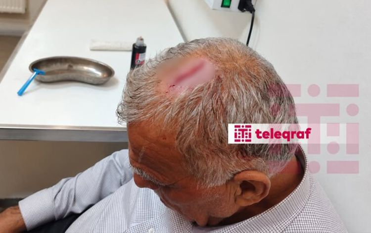 Şəkidə icra nümayəndəsi bələdiyyə sədrinin başına butulka çırpdı